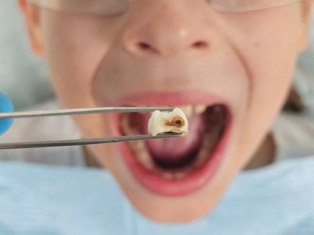 Best 24-Hour Emergency Dental Care in Contra Costa Centre, CA