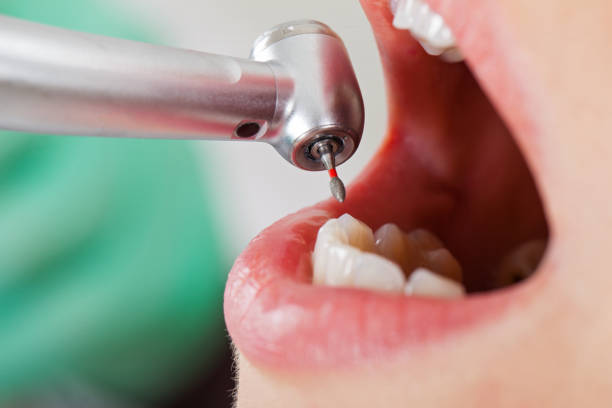 Best Emergency Orthodontic Repairs in Contra Costa Centre, CA